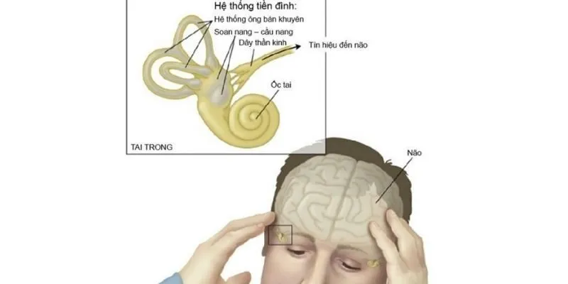 Bệnh rối loạn tiền đình