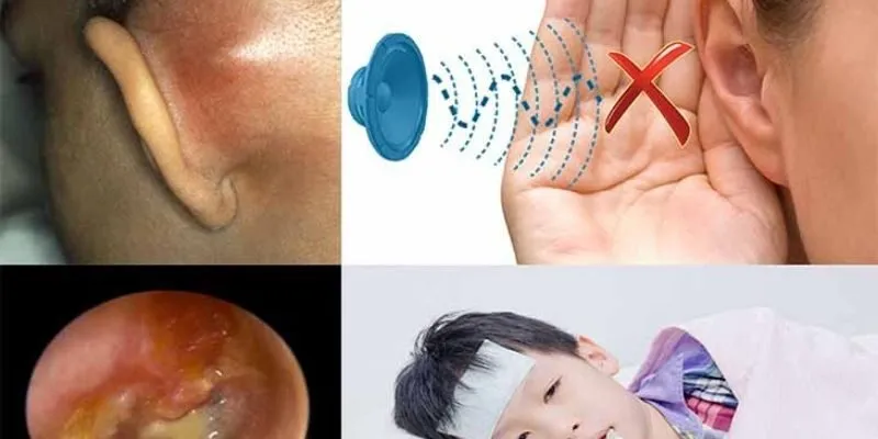 nguyên nhân gây ù tai