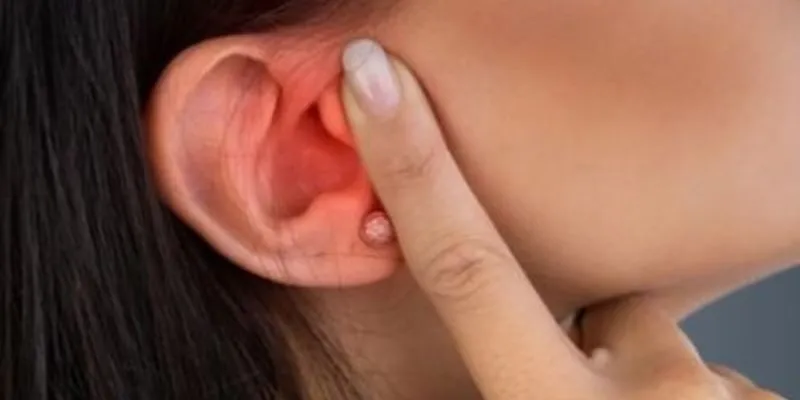 Điều trị chứng ù tai